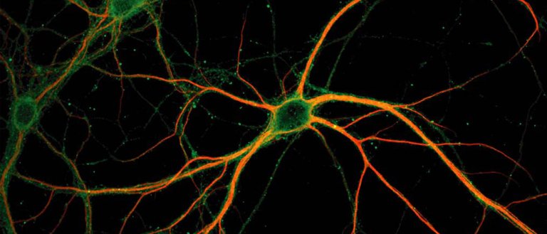 Scientists Claim That They Have Discovered How to “Delete” Unwanted Memories